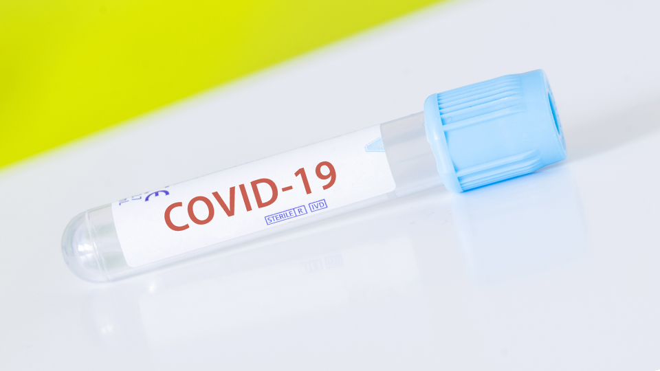 Provrör för covid-19-test